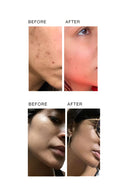 Skog Clarifying And Brightening Serum (30Ml)