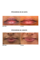 Skog Lip Repair Oil (10Ml)